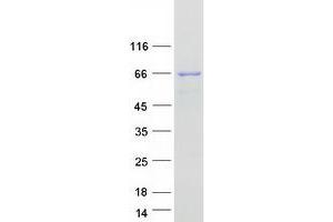 Validation with Western Blot