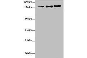 Western blot All lanes: ZNF148 antibody at 1. (ZNF148 抗体  (AA 690-794))