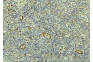 Immunohistochemistry (IHC) image for anti-Amine Oxidase, Copper Containing 3 (Vascular Adhesion Protein 1) (AOC3) (Internal Region) antibody (ABIN6259958)