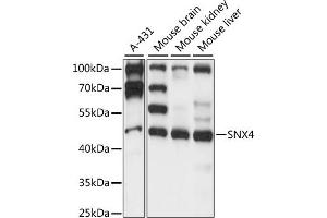 Western blot analysis of extracts of various cell lines, using SNX4 antibody (ABIN7270504) at 1:1000 dilution. (Sorting Nexin 4 抗体  (AA 1-250))
