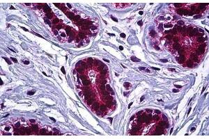 Human Breast: Formalin-Fixed, Paraffin-Embedded (FFPE) (IGF2R 抗体  (AA 2441-2490))