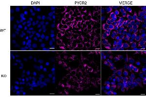 anti-Pyrroline-5-Carboxylate Reductase Family, Member 2 (PYCR2) antibody