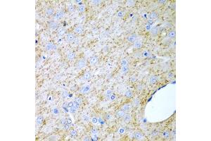 Immunohistochemistry of paraffin-embedded rat brain using Inhibin alpha (INHA) antibody (ABIN6128093, ABIN6142457, ABIN6142458 and ABIN6218833) at dilution of 1:200 (40x lens). (Inhibin alpha 抗体  (AA 19-366))