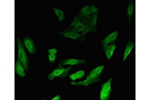 Immunofluorescent analysis of Hela cells using ABIN7160378 at dilution of 1:100 and Alexa Fluor 488-congugated AffiniPure Goat Anti-Rabbit IgG(H+L) (MYBL2 抗体  (AA 188-366))