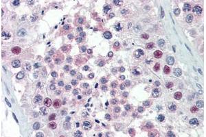 Human Testis (formalin-fixed, paraffin-embedded) stained with PRMT5 antibody ABIN337159 at 1:100 followed by biotinylated goat anti-rabbit IgG secondary antibody ABIN481713, alkaline phosphatase-streptavidin and chromogen. (PRMT5 抗体)