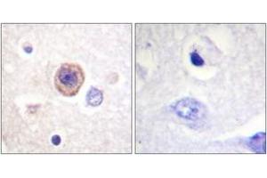 Immunohistochemistry analysis of paraffin-embedded human brain tissue, using Tryptophan Hydroxylase (Ab-58) Antibody. (Tryptophan Hydroxylase 1 抗体  (AA 26-75))