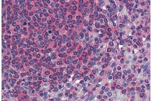 Anti-TM9SF3 antibody  ABIN960828 IHC staining of human spleen. (TM9SF3 抗体  (Internal Region))