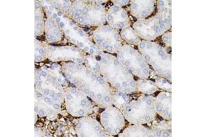 Immunohistochemistry of paraffin-embedded mouse kidney using MMP9 antibody (ABIN4904401) at dilution of 1:100 (40x lens). (MMP 9 抗体)
