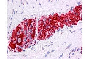 Anti-NR2E1 antibody IHC of human colon, myenteric plexus. (NR2E1 抗体  (N-Term))
