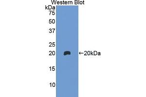 Figure. (Hemoglobin Subunit beta 抗体  (AA 1-147))
