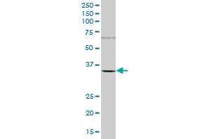 PSMB5 MaxPab polyclonal antibody.