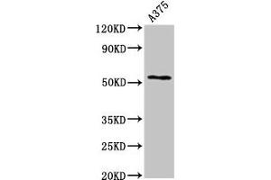 Western Blot Positive WB detected in: A375 whole cell lysate All lanes: CPE antibody at 2. (CPE 抗体  (AA 252-363))