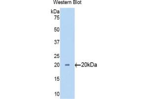 Western blot analysis of the recombinant protein. (CYP3A7 抗体  (AA 344-497))
