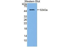 Detection of Recombinant MGMT, Rat using Polyclonal Antibody to O-6-Methylguanine DNA Methyltransferase (MGMT) (MGMT 抗体  (AA 1-209))