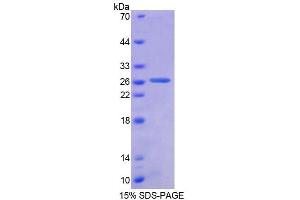 SDS-PAGE (SDS) image for Ancient Ubiquitous Protein 1 (Aup1) (AA 201-410) protein (His tag) (ABIN4989147) (Ancient Ubiquitous Protein 1 Protein (Aup1) (AA 201-410) (His tag))