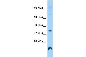 Host: Rabbit Target Name: C17orf108 Sample Type: Fetal Heart lysates Antibody Dilution: 1. (LYRM9 抗体  (Middle Region))