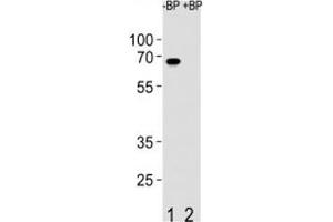 Western blot analysis of ETV5 antibody pre-incubated without (Lane 1) and with (2) blocking peptide in SW480 lysate (ETV5 抗体  (AA 8-36))