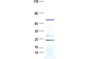 ARHGAP8 Protein (His tag)