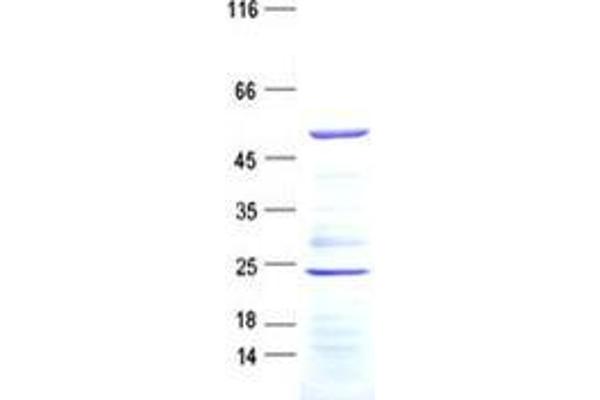 ARHGAP8 Protein (His tag)