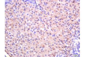 Formalin-fixed and paraffin embedded rat pancreas tissue labeled with Rabbit Anti-CTDSP2 Polyclonal Antibody, Unconjugated (ABIN2559702) at 1:200 followed by conjugation to the secondary antibody and DAB staining (CTDSP2 抗体  (AA 25-150))