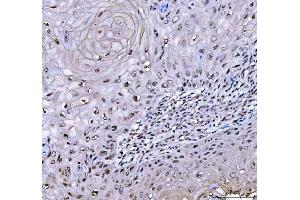 IHC analysis of RTCB using anti-RTCB antibody (ABIN7600722).
