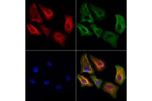 ABIN6264778 and ABIN6272928 staining Hela cells by IF/ICC. (Ribonuclease H1 抗体  (Internal Region))