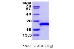 Figure annotation denotes ug of protein loaded and % gel used. (RAC3 Protein (AA 1-189))