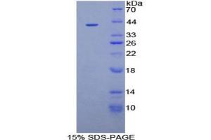 Rabbit Detection antibody from the kit in WB with Positive Control: Human placenta lysate. (IGFBPI CLIA Kit)