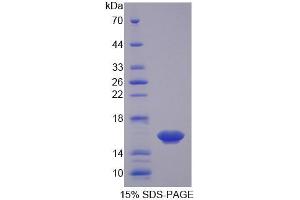 SDS-PAGE analysis of Mouse Osteoglycin Protein. (OGN 蛋白)