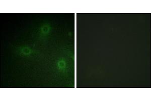 Immunofluorescence analysis of HeLa cells, using Neutrophil Cytosol Factor 1 (Ab-304) antibody. (NCF1 抗体)