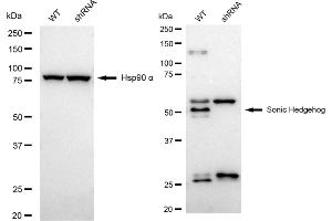 Western blotting analysis using sonic hedgehog antibody (ABIN7800969). (Recombinant Sonic Hedgehog Signaling Molecule 抗体)