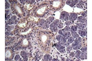 IHC-P Image Immunohistochemical analysis of human salivary gland cancer, using GPR114, antibody at 1:100 dilution. (GPR114 抗体)