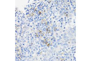 Immunohistochemistry (IHC) image for anti-Cathelicidin Antimicrobial Peptide (CAMP) (AA 31-170) antibody (ABIN3022306)