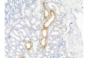 ABIN6256445 and ABIN6267615 at 1/100 staining human normal kidney tissue by IHC-P.