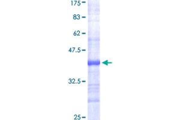 Fatty Acid Synthase Protein (FASN) (AA 2378-2477) (GST tag)