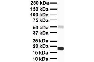 WB Suggested Anti-PPARA antibody Titration: 1 ug/mL Sample Type: Human heart (PPARA 抗体  (Middle Region))