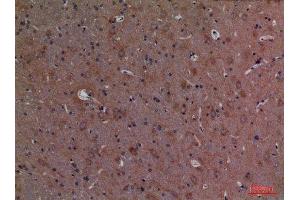 Immunohistochemistry (IHC) analysis of paraffin-embedded Rat Brain, antibody was diluted at 1:100. (CALB1 抗体  (C-Term))