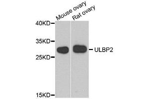 Western blot analysis of extract of mouse ovary and rat ovary cells, using ULBP2 antibody. (ULBP2 抗体)