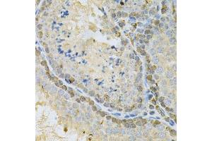 Immunohistochemistry of paraffin-embedded mouse testis using BUB1 Antibody. (BUB1 抗体  (AA 1-300))