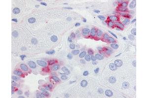 Immunohistochemistry (IHC) image for anti-Prostaglandin E Receptor 2 (Subtype EP2), 53kDa (PTGER2) (Cytoplasmic Domain) antibody (ABIN213470)