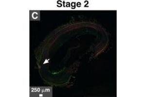 Immunohistological staining of artery tissues from diabetic subjects showing colocalization of serum proteins and mineral deposits. (Fetuin A 抗体  (AA 200-240) (AbBy Fluor® 594))