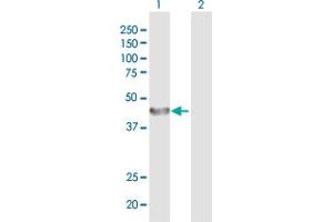 Western Blot analysis of ALG2 expression in transfected 293T cell line by ALG2 MaxPab polyclonal antibody. (ALG2 抗体  (AA 1-416))