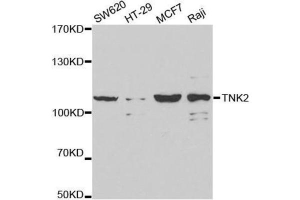 TNK2 抗体  (AA 70-385)