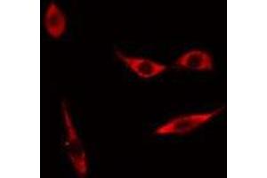 ABIN6275781 staining HuvEC cells by IF/ICC. (MYL3/CMLC1 抗体  (Internal Region))