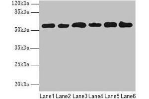 Western blot All lanes: PHF10 antibody at 8 μg/mL Lane 1: Hela whole cell lysate Lane 2: 293T whole cell lysate Lane 3: A2780 whole cell lysate Lane 4: U251 whole cell lysate Lane 5: A549 whole cell lysate Lane 6: A375 whole cell lysate Secondary Goat polyclonal to rabbit IgG at 1/10000 dilution Predicted band size: 57, 56, 52 kDa Observed band size: 57 kDa (PHF1 抗体  (AA 151-360))