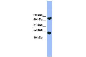 RWDD1 antibody used at 0. (RWDD1 抗体  (Middle Region))