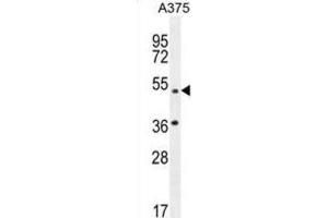Western Blotting (WB) image for anti-Adaptor-Related Protein Complex 1, mu 1 Subunit (AP1M1) antibody (ABIN2996504)