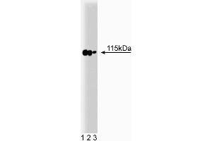 Western blot analysis of p115 on a rat cerebrum lysate. (ARHGAP4 抗体  (AA 843-955))