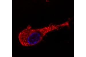 Immunofluorescence staining of neurofilament medium protein in murine Neuro2A cells by antibody conjugated with Dyomics 547 (red). (NEFM 抗体)