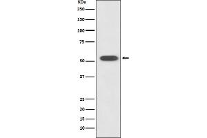 Western blot analysis of HSPA14 expression in K562 cell lysate.